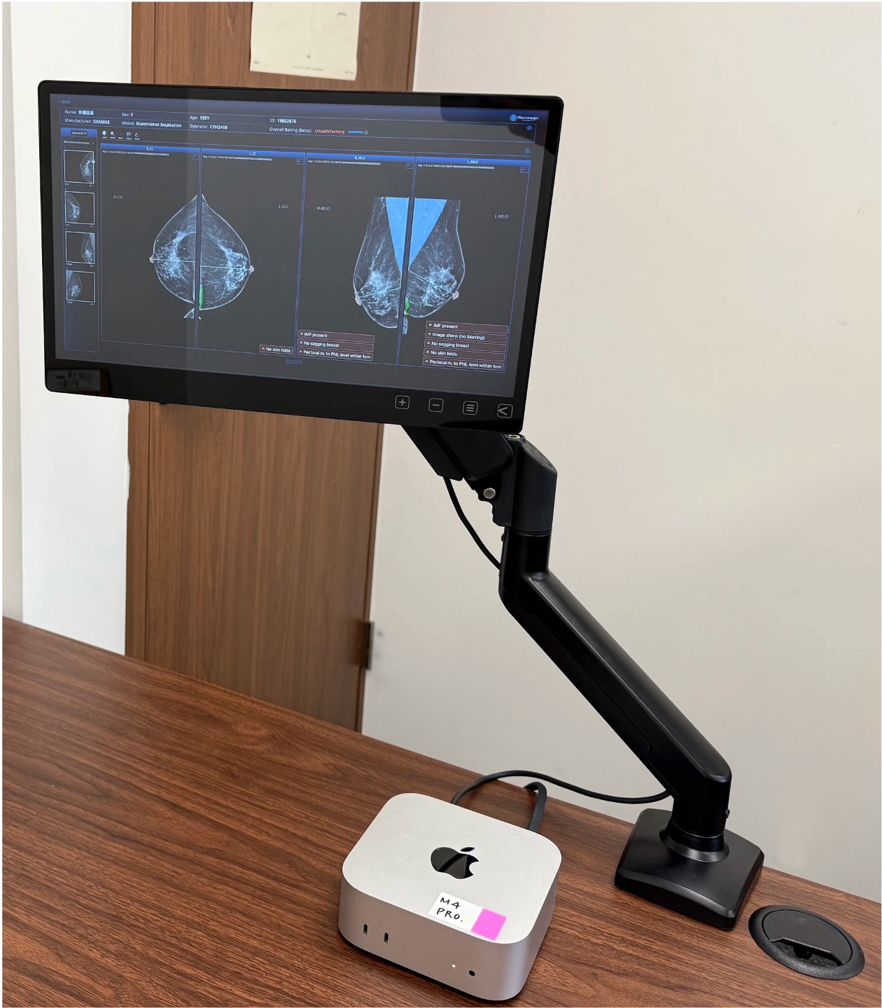 RibbonCare Edge Lite Kit